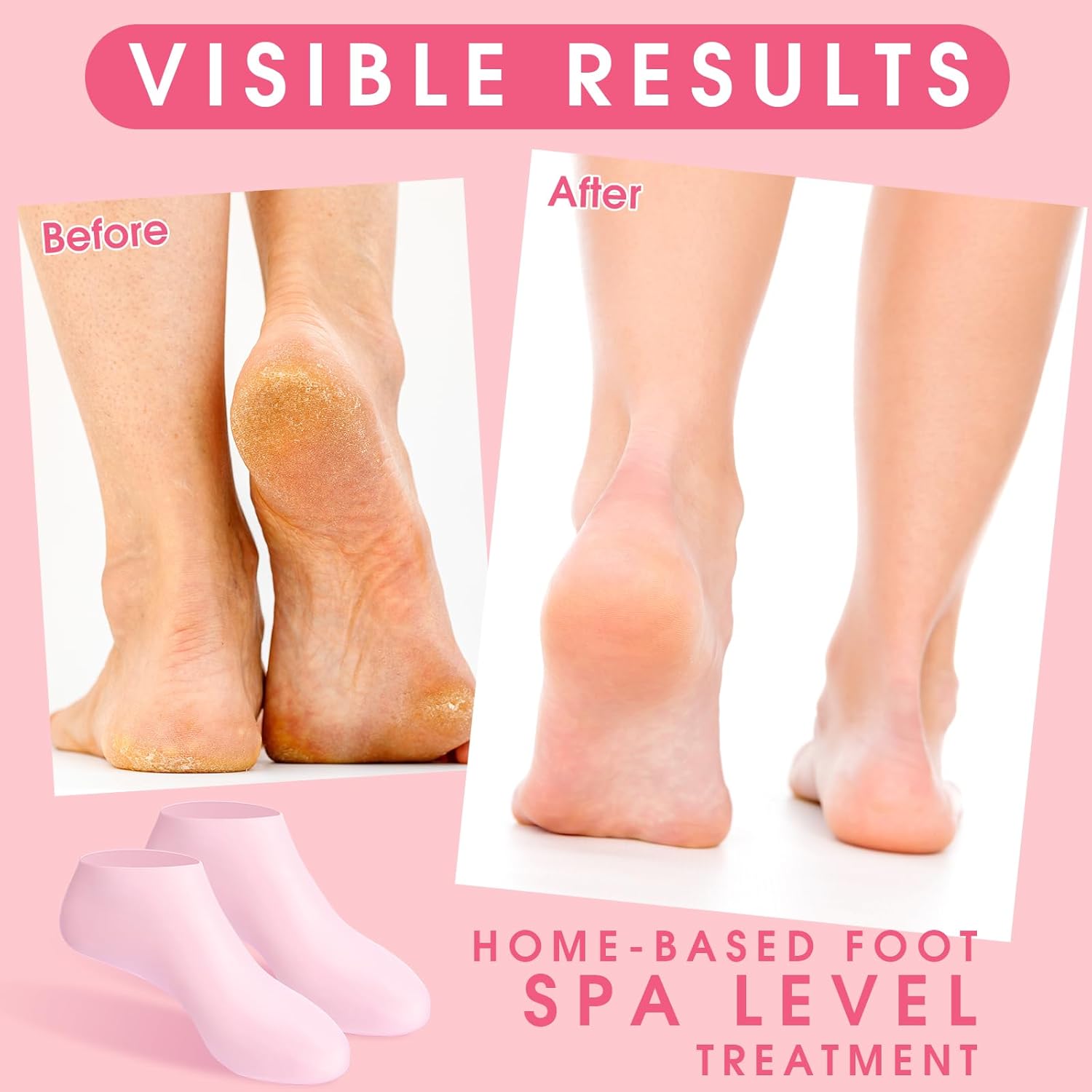 6 Pairs Silicone Moisturizing Gel Socks for Dry Cracked Feet – Hydrating Foot Mask Heel Repair Spa Socks for Soft Smooth Skin (Women Foot Care Treatment)